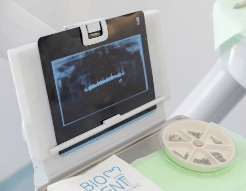 Biodent — radiografia panoramica